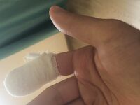 Абхазия предупреждает: морской дракончик, укол и скорая — будьте внимательны