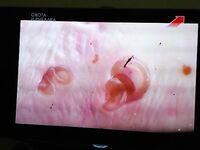 Нематоды в треске в Норвегии и что с этим делать