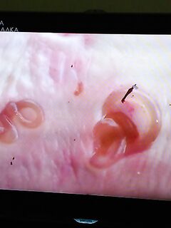 Нематоды в треске в Норвегии и что с этим делать